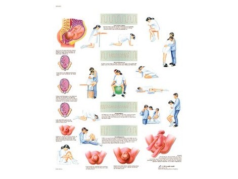 Print 3B Rehab Childbirth Print 3B Rehab Childbirth